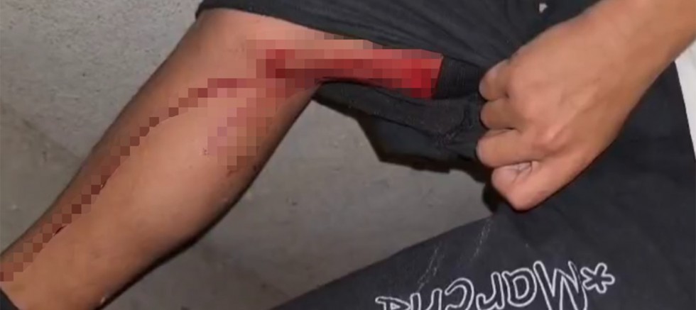 Diyarbakır'da maç kutlaması sırasında açılan ateş sonucu bir çocuk yaralandı