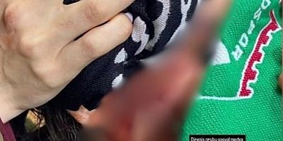 Amedspor Taraftarına  saldırı