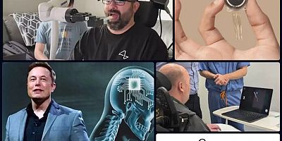 Beyin çipi sınırları aşıyor: Neuralink hastaları düşünce gücüyle robotik kol kontrolüne başladı