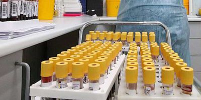 Coronavirus nedeniyle bir haftada 157 kişi hayatını kaybetti