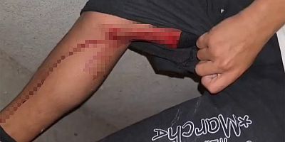 Diyarbakır'da maç kutlaması sırasında açılan ateş sonucu bir çocuk yaralandı