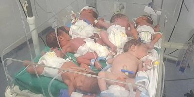Dr. Selmiye: Prematüre bebekler hayatta kalma mücadelesi veriyor