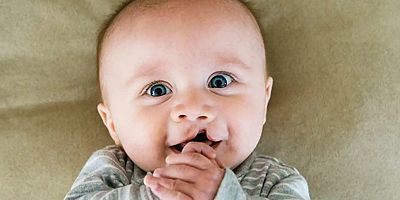 Dudak damak yarığıyla doğan bebeklerde ilk 48 saat çok önemli