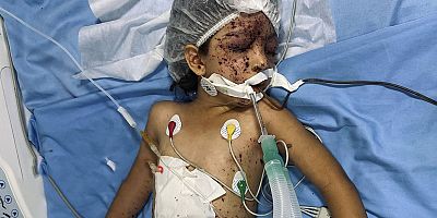 Dünya Sağlık Günü’nde Gazze’deki sağlık durumu hakkında çarpıcı rakamlar