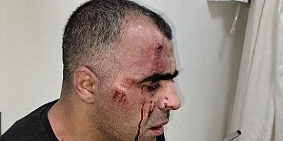 Gazeteci Sinan Aygül'e Saldırı Anı Güvenlik Kamerasına Yansıdı 