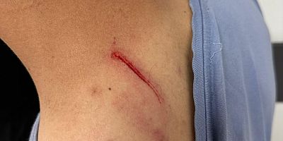 Gazi Yaşargil EAH'de Doktor ve Tıbbi Sekretere Saldırı İddiası