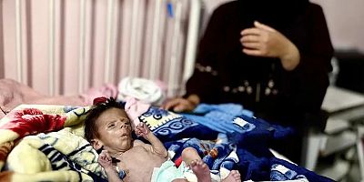 Gazze'de açlık can almaya devam ediyor: 6 kişi daha öldü