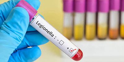 Lejyoner hastalığı Polonya’da yayılmaya devam ediyor, Avrupa panikte!