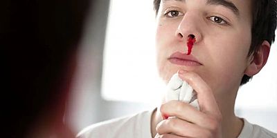 Sıcak havalarda burun kanamaları nedenlerine dikkat!