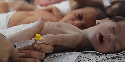 Siyonist işgalciler Gazze'de bir bebeği daha açlıktan öldürdü
